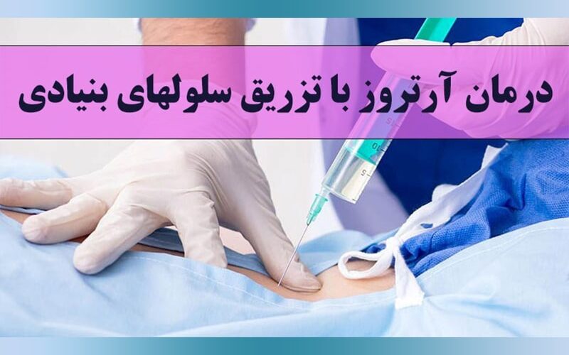 کنترل و درمان آرتروز با روش تزریق سلول بنیادی